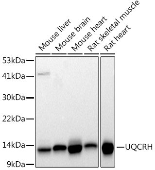 Western blot analysis of various lysates using  (A9395) at 1:1000 dilution.|Secondary antibody: HRP-conjugated Goat anti-Rabbit IgG (H+L) (AS014) at 1:10000 dilution.|Lysates/proteins: 25μg per lane.|Blocking buffer: 3% nonfat dry milk in TBST.|Detection: ECL Basic Kit (RM00020).|Exposure time: 30s.