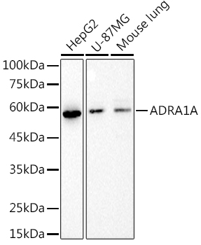 Western blot analysis of various lysates using  at 1:1000 dilution.|Secondary antibody: HRP-conjugated Goat anti-Rabbit IgG (H+L) at 1:10000 dilution.|Lysates/proteins: 25μg per lane.|Blocking buffer: 3% nonfat dry milk in TBST.|Detection: ECL Basic Kit.|Exposure time: 10s.