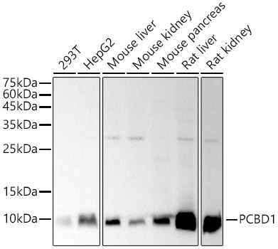 Western blot analysis of various lysates, using  at 1:1000 dilution.|Secondary antibody: HRP-conjugated Goat anti-Rabbit IgG (H+L) at 1:10000 dilution.|Lysates/proteins: 25μg  per lane.|Blocking buffer: 3% nonfat dry milk in TBST.|Detection: ECL Basic Kit.|Exposure time: 30s.