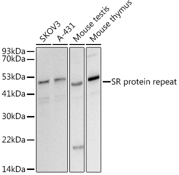 Western blot analysis of various lysates using  at 1:500 dilution.|Secondary antibody: HRP-conjugated Goat anti-Rabbit IgG (H+L) at 1:10000 dilution.|Lysates/proteins: 25μg per lane.|Blocking buffer: 3% nonfat dry milk in TBST.|Detection: ECL Basic Kit.|Exposure time: 30s.
