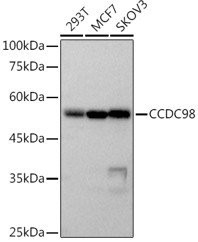 Western blot analysis of various lysates, using CCDC98 Rabbit mAb at 1:500 dilution.Secondary antibody: HRP-conjugated Goat anti-Rabbit IgG (H+L) at 1:10000 dilution.Lysates/proteins: 25μg per lane.Blocking buffer: 3% nonfat dry milk in TBST.Detection: ECL Basic Kit.Exposure time: 3s.