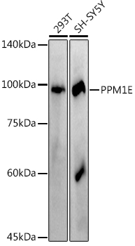 Western blot analysis of various lysates using PPM1E Rabbit mAb at 1:1000 dilution incubated overnight at 4°C.|Secondary antibody: HRP-conjugated Goat anti-Rabbit IgG (H+L) at 1:10000 dilution.|Lysates/proteins: 25 μg per lane.|Blocking buffer: 3% nonfat dry milk in TBST.|Detection: ECL Basic Kit.|Exposure time: 180 s.