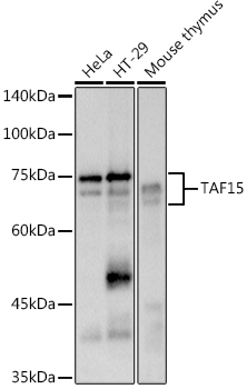 Western blot analysis of various lysates using  at 1:500 dilution.|Secondary antibody: HRP-conjugated Goat anti-Rabbit IgG (H+L) at 1:10000 dilution.|Lysates/proteins: 25μg per lane.|Blocking buffer: 3% nonfat dry milk in TBST.|Detection: ECL Basic Kit.|Exposure time: 1s.