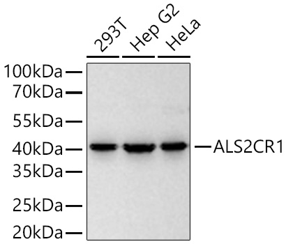 Western blot analysis of various lysates using ALS2CR1 Rabbit mAb at 2000 dilution incubated overnight at 4℃.|Secondary antibody: HRP-conjugated Goat anti-Rabbit IgG (H+L) at 1:10000 dilution.|Lysates/proteins: 25 μg per lane.|Blocking buffer: 3% nonfat dry milk in TBST.|Detection: ECL Basic Kit.|Exposure time: 45 s.