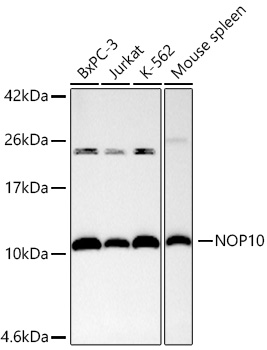 Western blot analysis of various lysates using  at 1:1000 dilution.|Secondary antibody: HRP-conjugated Goat anti-Rabbit IgG (H+L) at 1:10000 dilution.|Lysates/proteins: 25μg per lane.|Blocking buffer: 3% nonfat dry milk in TBST.|Detection: ECL Basic Kit.|Exposure time: 90s.