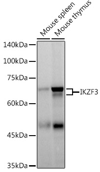 Western blot analysis of various lysates using IKZF3 Rabbit mAb at 1:500 dilution.|Secondary antibody: HRP-conjugated Goat anti-Rabbit IgG (H+L) at 1:10000 dilution.|Lysates/proteins: 25μg per lane.|Blocking buffer: 3% nonfat dry milk in TBST.|Detection: ECL Basic Kit.|Exposure time: 60s.