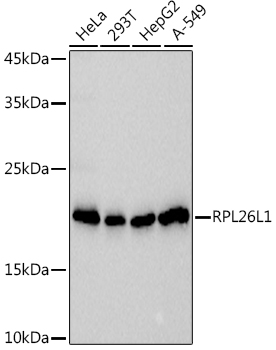 Western blot analysis of various lysates using  at 1:1000 dilution.|Secondary antibody: HRP-conjugated Goat anti-Rabbit IgG (H+L) at 1:10000 dilution.|Lysates/proteins: 25μg per lane.|Blocking buffer: 3% nonfat dry milk in TBST.|Detection: ECL Basic Kit.|Exposure time: 3s.