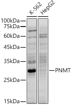 Western blot analysis of various lysates using PNMT Rabbit mAb at 1:1000 dilution.|Secondary antibody: HRP-conjugated Goat anti-Rabbit IgG (H+L) at 1:10000 dilution.|Lysates/proteins: 25μg per lane.|Blocking buffer: 3% nonfat dry milk in TBST.|Detection: ECL Enhanced Kit.|Exposure time: 60s.