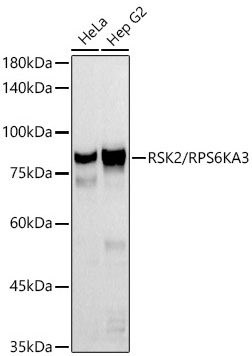 Western blot analysis of various lysates using RSK2 / RPS6KA3 Rabbit mAb at 1:500 dilution.|Secondary antibody: HRP-conjugated Goat anti-Rabbit IgG (H+L) at 1:10000 dilution.|Lysates/proteins: 25μg per lane.|Blocking buffer: 3% nonfat dry milk in TBST.|Detection: ECL Basic Kit.|Exposure time: 60s.
