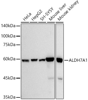 Western blot analysis of various lysates using ALDH7A1 Rabbit mAb at 1:500 dilution.|Secondary antibody: HRP-conjugated Goat anti-Rabbit IgG (H+L) at 1:10000 dilution.|Lysates/proteins: 25μg per lane.|Blocking buffer: 3% nonfat dry milk in TBST.|Detection: ECL Basic Kit.|Exposure time: 10s.
