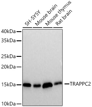 Western blot analysis of various lysates using TRAPPC2 Rabbit mAb (A20890) at 1:1000 dilution incubated at room temperature for 1.5 hours.|Secondary antibody: HRP-conjugated Goat anti-Rabbit IgG (H+L) (AS014) at 1:10000 dilution.|Lysates/proteins: 25 μg per lane.|Blocking buffer: 3% nonfat dry milk in TBST.|Detection: ECL Basic Kit (RM00020).|Exposure time: 5 s.