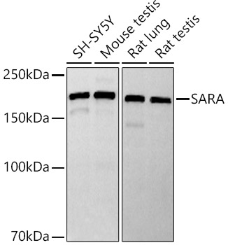 Western blot analysis of various lysates, using SARA Rabbit mAb at 1:1000 dilution.|Secondary antibody: HRP-conjugated Goat anti-Rabbit IgG (H+L) at 1:10000 dilution.|Lysates/proteins: 25μg per lane.|Blocking buffer: 3% nonfat dry milk in TBST.|Detection: ECL Basic Kit.|Exposure time: 90s.