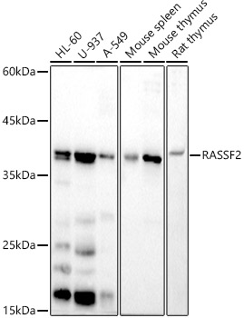 Western blot analysis of various lysates, using RASSF2 Rabbit mAb at 1:500 dilution.|Secondary antibody: HRP-conjugated Goat anti-Rabbit IgG (H+L) at 1:10000 dilution.|Lysates/proteins: 25μg per lane.|Blocking buffer: 3% nonfat dry milk in TBST.|Detection: ECL Basic Kit.|Exposure time: 180s.