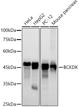 Western blot analysis of various lysates using BCKDK Rabbit mAb at 1:500 dilution.|Secondary antibody: HRP-conjugated Goat anti-Rabbit IgG (H+L) at 1:10000 dilution.|Lysates/proteins: 25μg per lane.|Blocking buffer: 3% nonfat dry milk in TBST.|Detection: ECL Basic Kit.|Exposure time: 30s.