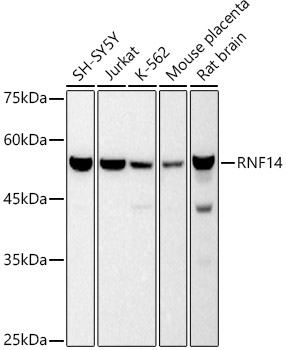 Western blot analysis of various lysates using RNF14 Rabbit mAb at 1:500 dilution.|Secondary antibody: HRP-conjugated Goat anti-Rabbit IgG (H+L) at 1:10000 dilution.|Lysates/proteins: 25μg per lane.|Blocking buffer: 3% nonfat dry milk in TBST.|Detection: ECL Basic Kit.|Exposure time: 10s.