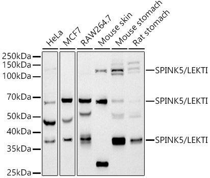 Western blot analysis of various lysates using SPINK5 / LEKTI Rabbit mAb at 1:1000 dilution.|Secondary antibody: HRP-conjugated Goat anti-Rabbit IgG (H+L) at 1:10000 dilution.|Lysates/proteins: 25μg per lane.|Blocking buffer: 3% nonfat dry milk in TBST.|Detection: ECL Basic Kit.|Exposure time: 90s.