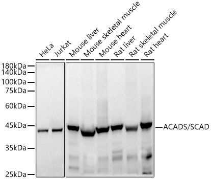 Western blot analysis of various lysates using ACADS / SCAD Rabbit mAb at 1:500 dilution.|Secondary antibody: HRP-conjugated Goat anti-Rabbit IgG (H+L) at 1:10000 dilution.|Lysates/proteins: 25μg per lane.|Blocking buffer: 3% nonfat dry milk in TBST.|Detection: ECL Basic Kit.|Exposure time: 10s.