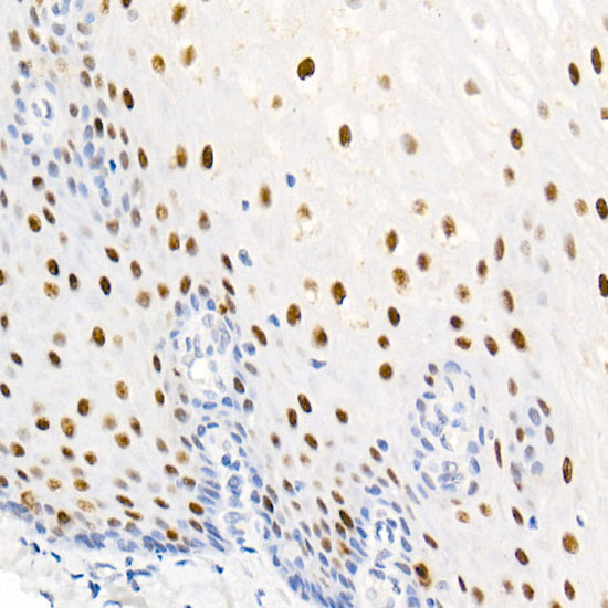 Immunohistochemistry analysis of paraffin-embedded Human esophagus using Phospho-Nucleolin-T76 Rabbit mAb at dilution of 1:50 (40x lens). High pressure antigen retrieval performed with 0.01M Citrate buffer (pH 6.0) prior to IHC staining.