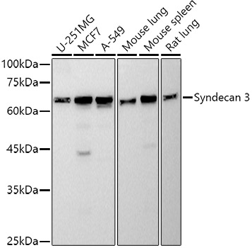 Western blot analysis of various lysates using Syndecan 3 Rabbit mAb at 1:500 dilution.|Secondary antibody: HRP-conjugated Goat anti-Rabbit IgG (H+L) at 1:10000 dilution.|Lysates/proteins: 25μg per lane.|Blocking buffer: 3% nonfat dry milk in TBST.|Detection: ECL Basic Kit.|Exposure time: 30s.