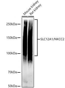 Western blot analysis of various lysates using SLC12A1 / NKCC2 Rabbit mAb at 1:1000 dilution.|Secondary antibody: HRP-conjugated Goat anti-Rabbit IgG (H+L) at 1:10000 dilution.|Lysates/proteins: 25μg per lane.|Blocking buffer: 3% nonfat dry milk in TBST.|Detection: ECL Basic Kit.|Exposure time: 60s.