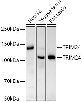 Western blot analysis of various lysates using TRIM24 Rabbit mAb (A20938) at 1:1000 dilution.|Secondary antibody: HRP-conjugated Goat anti-Rabbit IgG (H+L) (AS014) at 1:10000 dilution.|Lysates/proteins: 25μg per lane.|Blocking buffer: 3% nonfat dry milk in TBST.|Detection: ECL Basic Kit (RM00020).|Exposure time: 60s.