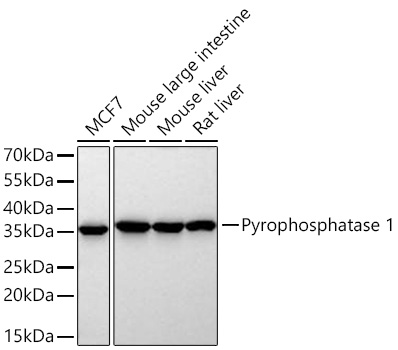 Western blot analysis of various lysates using Pyrophosphatase 1 Rabbit mAb at 1:2000 dilution incubated at room temperature for 1.5 hours.|Secondary antibody: HRP-conjugated Goat anti-Rabbit IgG (H+L) at 1:10000 dilution.|Lysates/proteins: 25 μg per lane.|Blocking buffer: 3% nonfat dry milk in TBST.|Detection: ECL Basic Kit.|Exposure time: 90 s.