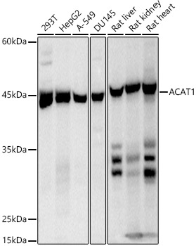 Western blot analysis of various lysates using ACAT1 Rabbit mAb at 1:500 dilution.|Secondary antibody: HRP-conjugated Goat anti-Rabbit IgG (H+L) at 1:10000 dilution.|Lysates/proteins: 25μg per lane.|Blocking buffer: 3% nonfat dry milk in TBST.|Detection: ECL Basic Kit.|Exposure time: 1s.
