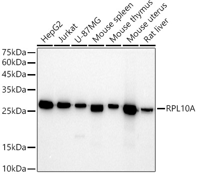 Western blot analysis of various lysates using RPL10A Rabbit mAb at 1:500 dilution.|Secondary antibody: HRP-conjugated Goat anti-Rabbit IgG (H+L) at 1:10000 dilution.|Lysates/proteins: 25μg per lane.|Blocking buffer: 3% nonfat dry milk in TBST.|Detection: ECL Basic Kit.|Exposure time: 30s.