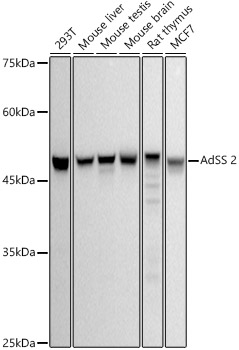 Western blot analysis of various lysates using AdSS 2 Rabbit mAb at 1:500 dilution.|Secondary antibody: HRP-conjugated Goat anti-Rabbit IgG (H+L) at 1:10000 dilution.|Lysates/proteins: 25μg per lane.|Blocking buffer: 3% nonfat dry milk in TBST.|Detection: ECL Basic Kit.|Exposure time: 10s.