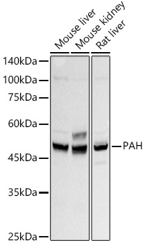 Western blot analysis of various lysates using PAH Rabbit mAb at 1:500 dilution.|Secondary antibody: HRP-conjugated Goat anti-Rabbit IgG (H+L) at 1:10000 dilution.|Lysates/proteins: 25μg per lane.|Blocking buffer: 3% nonfat dry milk in TBST.|Detection: ECL Basic Kit.|Exposure time: 10s.