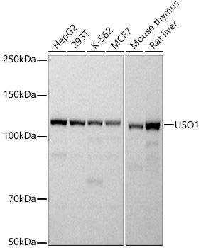 Western blot analysis of various lysates using USO1 Rabbit mAb (A20950) at 1:500 dilution.|Secondary antibody: HRP-conjugated Goat anti-Rabbit IgG (H+L) (AS014) at 1:10000 dilution.|Lysates/proteins: 25μg per lane.|Blocking buffer: 3% nonfat dry milk in TBST.|Detection: ECL Basic Kit (RM00020).|Exposure time: 1s.