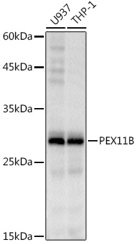 Western blot analysis of various lysates using PEX11B Rabbit mAb at 1:1000 dilution.|Secondary antibody: HRP-conjugated Goat anti-Rabbit IgG (H+L) at 1:10000 dilution.|Lysates/proteins: 25μg per lane.|Blocking buffer: 3% nonfat dry milk in TBST.|Detection: ECL Basic Kit.|Exposure time: 10s.