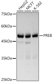Western blot analysis of various lysates using PREB Rabbit mAb at 1:1000 dilution.|Secondary antibody: HRP-conjugated Goat anti-Rabbit IgG (H+L) at 1:10000 dilution.|Lysates/proteins: 25μg per lane.|Blocking buffer: 3% nonfat dry milk in TBST.|Detection: ECL Basic Kit.|Exposure time: 30s.