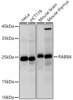 Western blot analysis of various lysates using RAB8A Rabbit mAb at 1:1000 dilution.|Secondary antibody: HRP-conjugated Goat anti-Rabbit IgG (H+L) at 1:10000 dilution.|Lysates/proteins: 25μg per lane.|Blocking buffer: 3% nonfat dry milk in TBST.|Detection: ECL Basic Kit.|Exposure time: 3s.