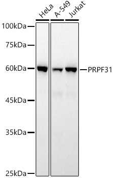 Western blot analysis of various lysates using PRPF31 Rabbit mAb at 1:1000 dilution.|Secondary antibody: HRP-conjugated Goat anti-Rabbit IgG (H+L) at 1:10000 dilution.|Lysates/proteins: 25μg per lane.|Blocking buffer: 3% nonfat dry milk in TBST.|Detection: ECL Basic Kit.|Exposure time: 60s.