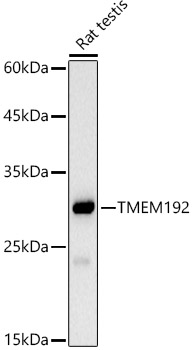 Western blot analysis of lysates from Rat testis using TMEM192 Rabbit mAb (A21165) at 1:1000 dilution.|Secondary antibody: HRP-conjugated Goat anti-Rabbit IgG (H+L) (AS014) at 1:10000 dilution.|Lysates/proteins: 25 μg per lane.|Blocking buffer: 3% nonfat dry milk in TBST.|Detection: ECL Basic Kit (RM00020).|Exposure time: 30s.