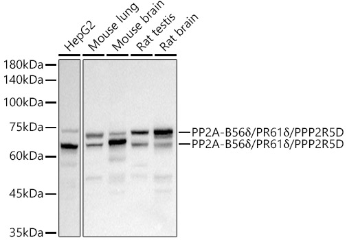 Western blot analysis of various lysates, using PP2A-B56δ/PR61δ/PPP2R5D Rabbit mAb at1:1000 dilution.Secondary antibody: HRP-conjugated Goat anti-Rabbit IgG (H+L) at 1:10000 dilution.Lysates/proteins: 25μg per lane.Blocking buffer: 3% nonfat dry milk in TBST.Detection: ECL Basic Kit.Exposure time: 3s.