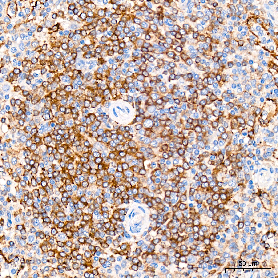 Immunohistochemistry analysis of paraffin-embedded Human spleen tissue using SNX5 Rabbit mAb at a dilution of 1:200 (40x lens). High pressure antigen retrieval was performed with 0.01 M citrate buffer (pH 6.0) prior to IHC staining.