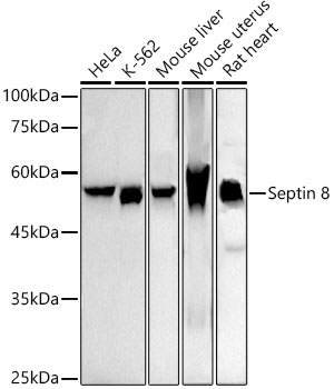 Western blot analysis of various lysates using Septin 8 Rabbit mAb at1:1000 dilution.|Secondary antibody: HRP-conjugated Goat anti-Rabbit IgG (H+L) at 1:10000 dilution.|Lysates/proteins: 25μg per lane.|Blocking buffer: 3% nonfat dry milk in TBST.|Detection: ECL Basic Kit.|Exposure time: 90s.