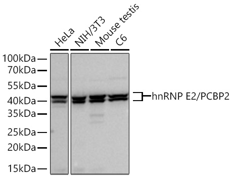 Western blot analysis of various lysates using hnRNP E2/PCBP2 Rabbit mAb at 1:1000 dilution incubated overnight at 4℃.|Secondary antibody: HRP-conjugated Goat anti-Rabbit IgG (H+L) at 1:10000 dilution.|Lysates/proteins: 25 μg per lane.|Blocking buffer: 3% nonfat dry milk in TBST.|Detection: ECL Basic Kit.|Exposure time: 30s.
