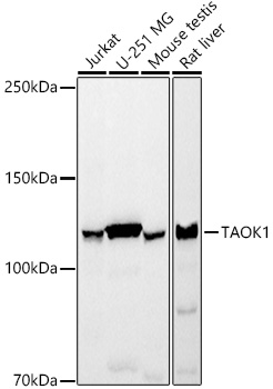 Western blot analysis of various lysates, using TAOK1 Rabbit mAb at1:1000 dilution.|Secondary antibody: HRP-conjugated Goat anti-Rabbit IgG (H+L) at 1:10000 dilution.|Lysates/proteins: 25μg  per lane.|Blocking buffer: 3% nonfat dry milk in TBST.|Detection: ECL Basic Kit.|Exposure time: 3s.