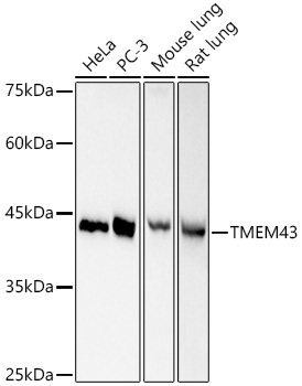 Western blot analysis of various lysates, using TMEM43 Rabbit mAb (A21160) at 1:1000 dilution.|Secondary antibody: HRP-conjugated Goat anti-Rabbit IgG (H+L) (AS014) at 1:10000 dilution.|Lysates/proteins: 25μg per lane.|Blocking buffer: 3% nonfat dry milk in TBST.|Detection: ECL Basic Kit (RM00020).|Exposure time: 30s.