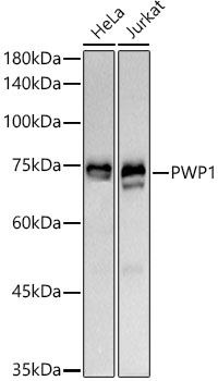 Western blot analysis of various lysates using PWP1 Rabbit mAb at1:1000 dilution.|Secondary antibody: HRP-conjugated Goat anti-Rabbit IgG (H+L) at 1:10000 dilution.|Lysates/proteins: 25μg per lane.|Blocking buffer: 3% nonfat dry milk in TBST.|Detection: ECL Basic Kit.|Exposure time: 30s.