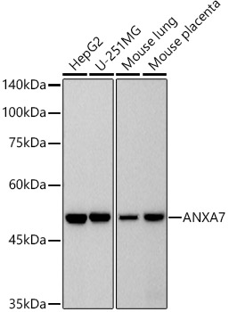Western blot analysis of various lysates, using ANXA7 Rabbit mAb at1:500 dilution.|Secondary antibody: HRP-conjugated Goat anti-Rabbit IgG (H+L) at 1:10000 dilution.|Lysates/proteins: 25μg per lane.|Blocking buffer: 3% nonfat dry milk in TBST.|Detection: ECL Basic Kit.|Exposure time: 60s.