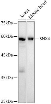 Western blot analysis of  various lysates, using SNX4 Rabbit mAb at1:1000 dilution.|Secondary antibody: HRP-conjugated Goat anti-Rabbit IgG (H+L) at 1:10000 dilution.|Lysates/proteins: 25μg  per lane.|Blocking buffer: 3% nonfat dry milk in TBST.|Detection: ECL Basic Kit.|Exposure time: 180s.