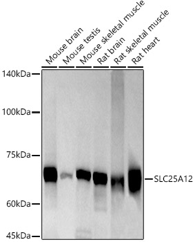 Western blot analysis of various lysates using SLC25A12 Rabbit mAb at1:1000 dilution.|Secondary antibody: HRP-conjugated Goat anti-Rabbit IgG (H+L) at 1:10000 dilution.|Lysates/proteins: 25μg per lane.|Blocking buffer: 3% nonfat dry milk in TBST.|Detection: ECL Basic Kit.|Exposure time: 60s.