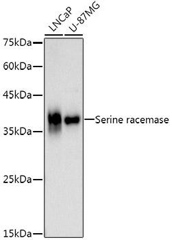 Western blot analysis of various lysates using Serine racemase Rabbit mAb at1:1000 dilution.|Secondary antibody: HRP-conjugated Goat anti-Rabbit IgG (H+L) at 1:10000 dilution.|Lysates/proteins: 25μg per lane.|Blocking buffer: 3% nonfat dry milk in TBST.|Detection: ECL Basic Kit.|Exposure time: 90s.