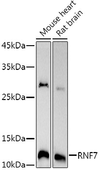 Western blot analysis of various lysates using RNF7 Rabbit mAb at1:1000 dilution.|Secondary antibody: HRP-conjugated Goat anti-Rabbit IgG (H+L) at 1:10000 dilution.|Lysates/proteins: 25μg per lane.|Blocking buffer: 3% nonfat dry milk in TBST.|Detection: ECL Basic Kit.|Exposure time: 180s.