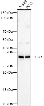 Western blot analysis of various lysates, using CBR1 Rabbit mAb at 1:1000 dilution.|Secondary antibody: HRP-conjugated Goat anti-Rabbit IgG (H+L) at 1:10000 dilution.|Lysates/proteins: 25μg per lane.|Blocking buffer: 3% nonfat dry milk in TBST.|Detection: ECL Basic Kit.|Exposure time: 60s.