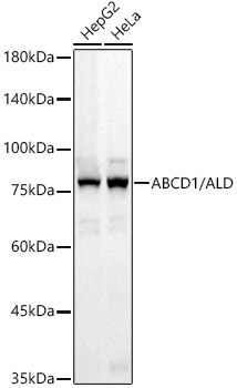 Western blot analysis of various lysates, using ABCD1 / ALD Rabbit mAb Rabbit mAb (A23569) at 1:1000 dilution.|Secondary antibody: HRP-conjugated Goat anti-Rabbit IgG (H+L) (AS014) at 1:10000 dilution.|Lysates/proteins: 25μg per lane.|Blocking buffer: 3% nonfat dry milk in TBST.|Detection: ECL Basic Kit (RM00020).|Exposure time: 20s.